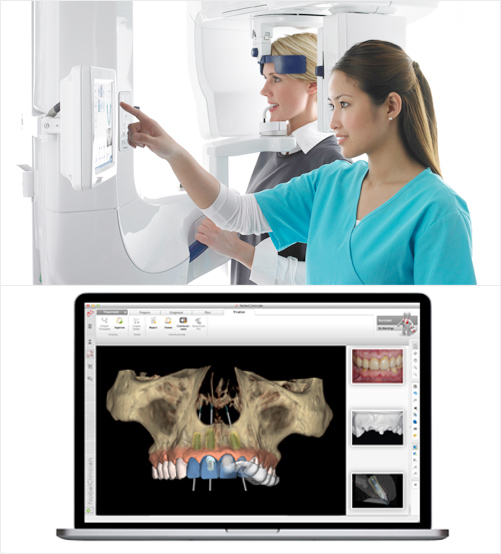 Benefits of Computer Guided Implant Surgery