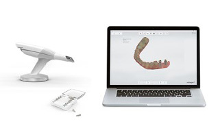 Digital Dentistry-3D Intra Oral Scanning