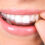 How to look after Invisalign braces
