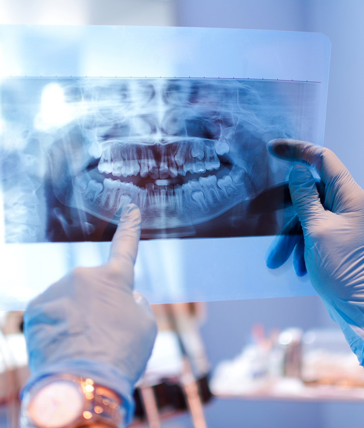 When Might You Need Full Mouth Reconstruction?
