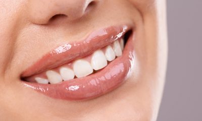 How Much Do Dental Veneers Cost and Are They Worth It?