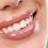How Much Do Dental Veneers Cost and Are They Worth It?