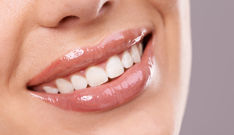 How Much Do Dental Veneers Cost and Are They Worth It?