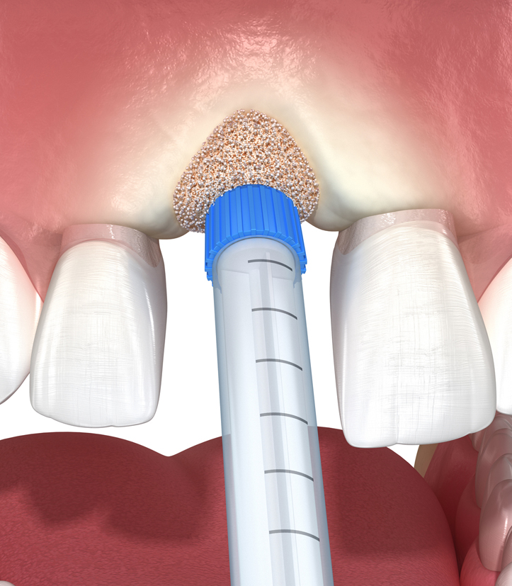 Why Choose Wayside Dental Practice in Harpenden and St Albans?